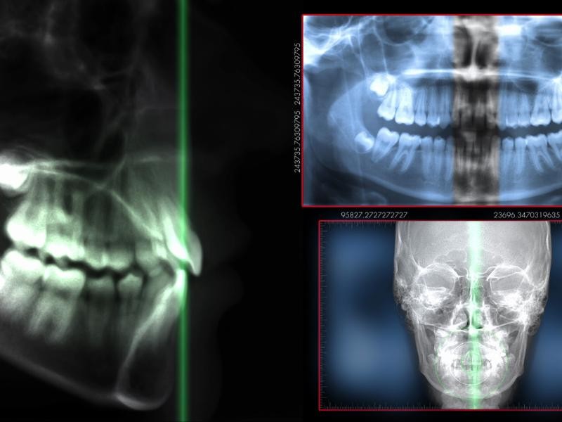 Radiografia digital